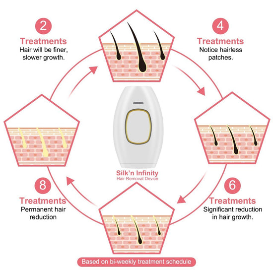 Freezing Point Laser Hair Removal Apparatus Handheld Facial Whole Body Beauty Apparatus Female ipl Photon Laser Hair Removal Apparatus - Urban Glow Mama